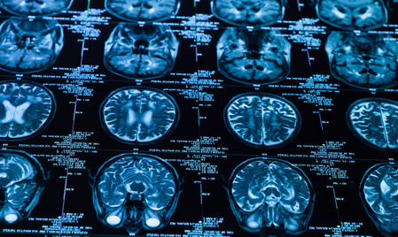 Using the brain to heal the body
