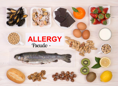 Chronic urticaria (hives) linked to histamine foods