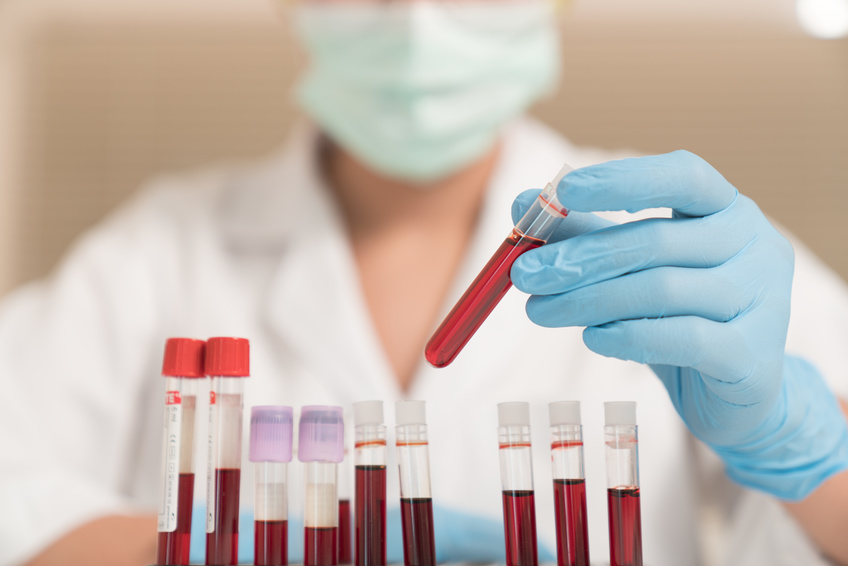 Histamine intolerance, mast cells & autoimmune disorders