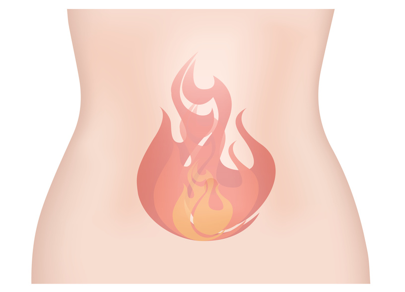 Histamine Intolerance GERD Solutions